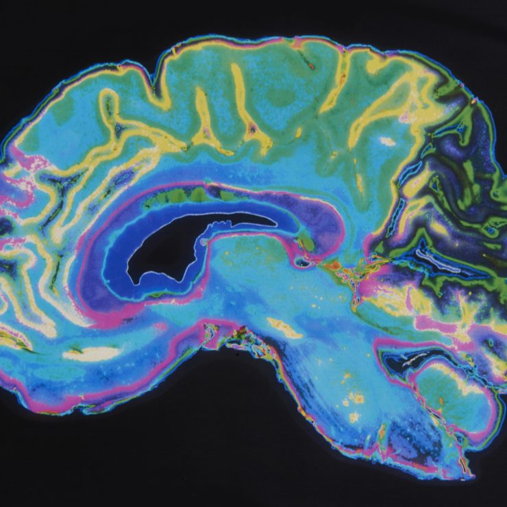 MRI scan of a brain to demonstrate how scientists at the Center are exploring how the brain works through the lens of data.