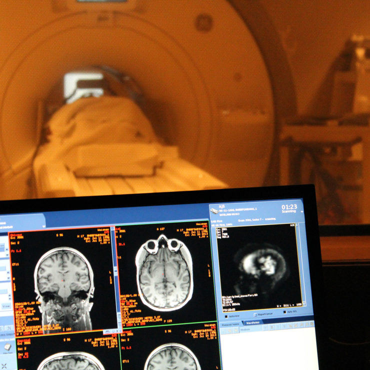 fMRI Scan Screen Machine